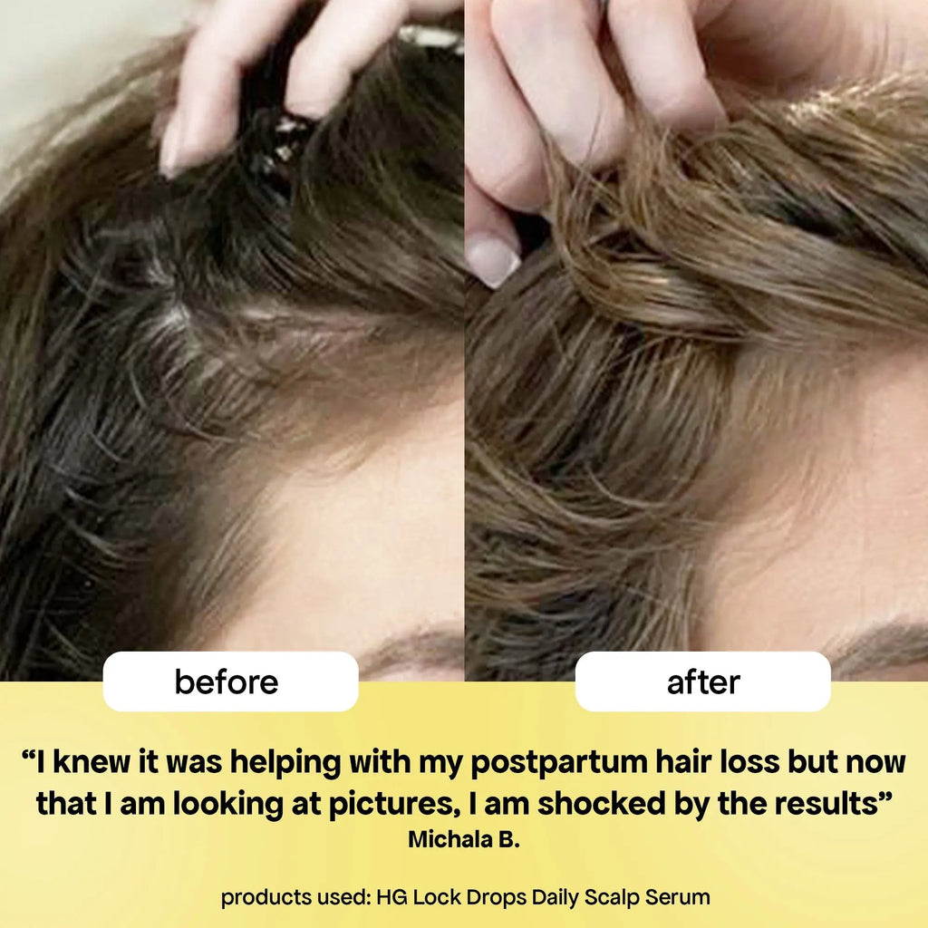 LOCK-IN THICKER HAIR: 3-MONTH SUPPLY