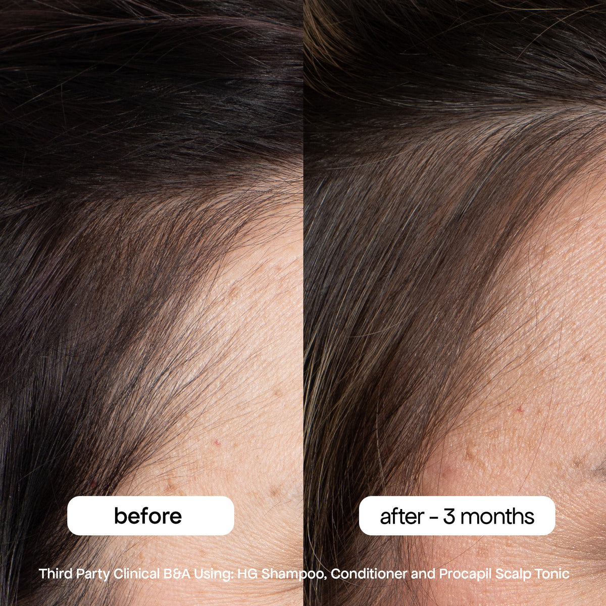 ANTI-THINNING SUPER SYSTEM