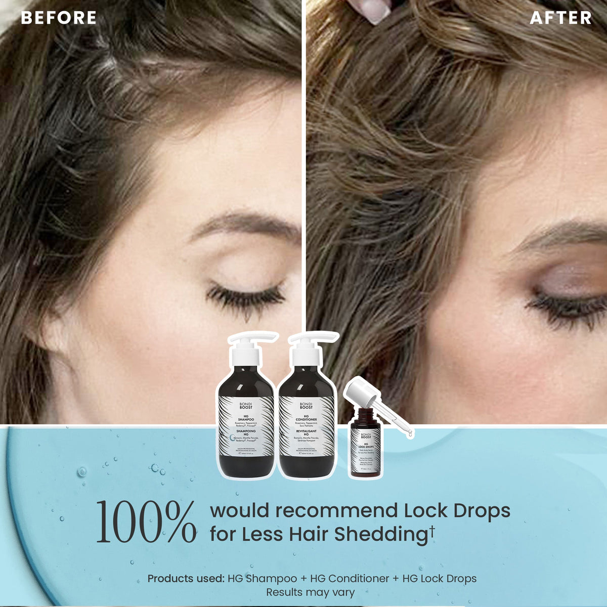 POSTPARTUM HAIR RECOVERY