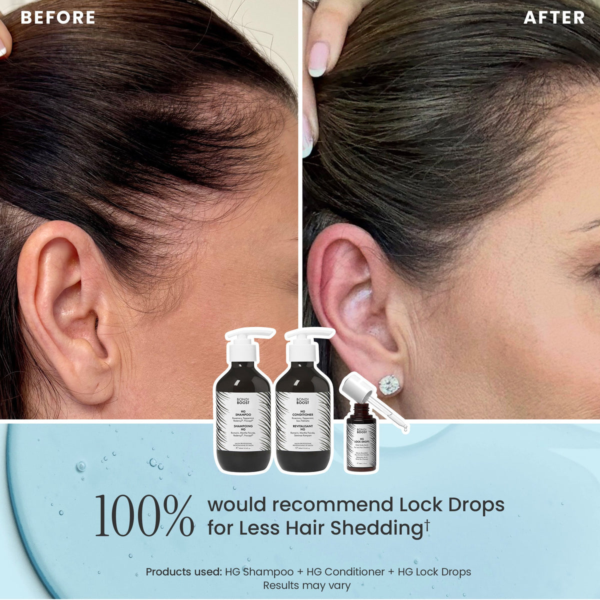 POSTPARTUM HAIR RECOVERY