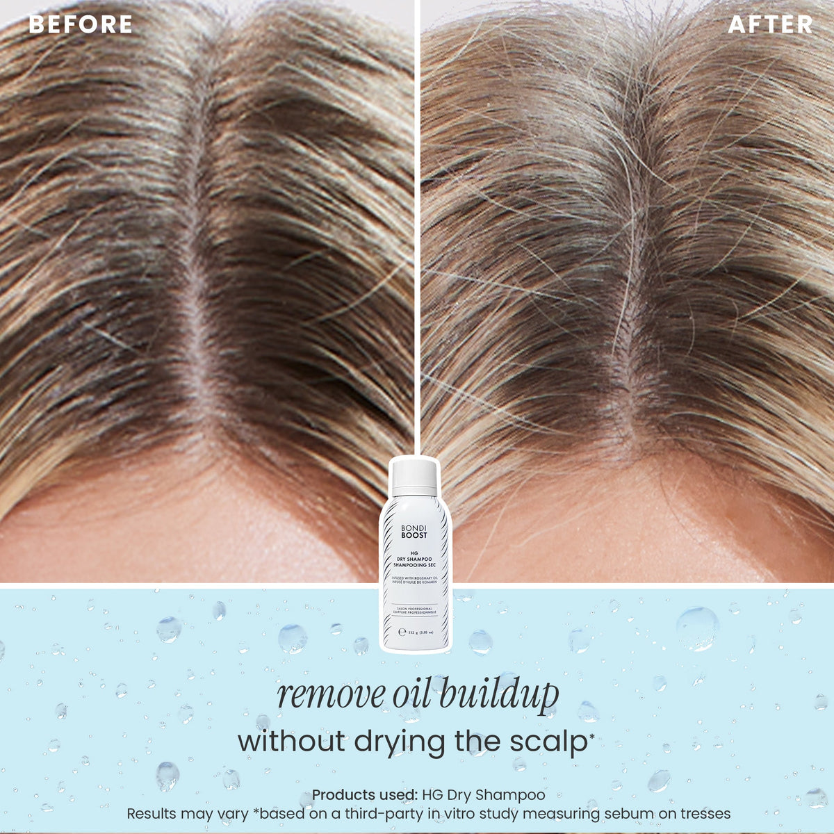 DRY SHAMPOO - 3 PACK